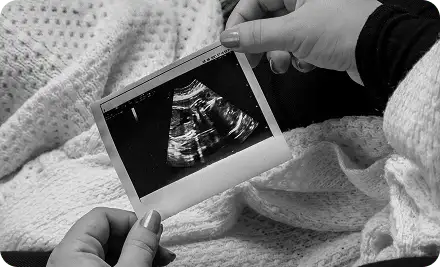 Two hands holding an ultrasound photograph above a knitted blanket