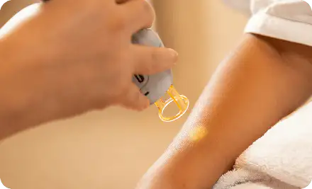 A handheld laser device being applied to the skin of a patient's arm