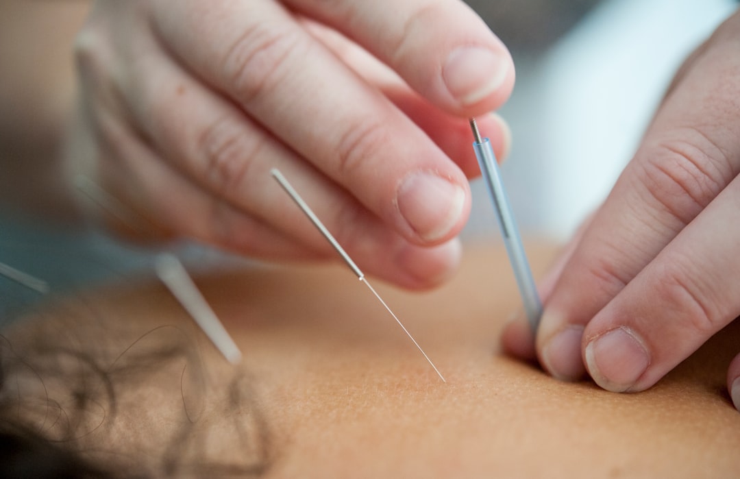 Acupuncture care at HALO