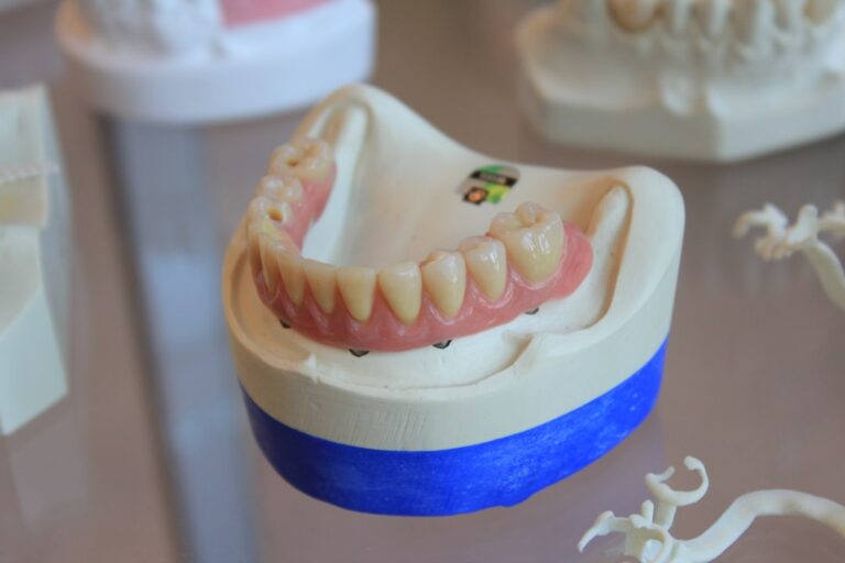 A set of dentures on a display rack