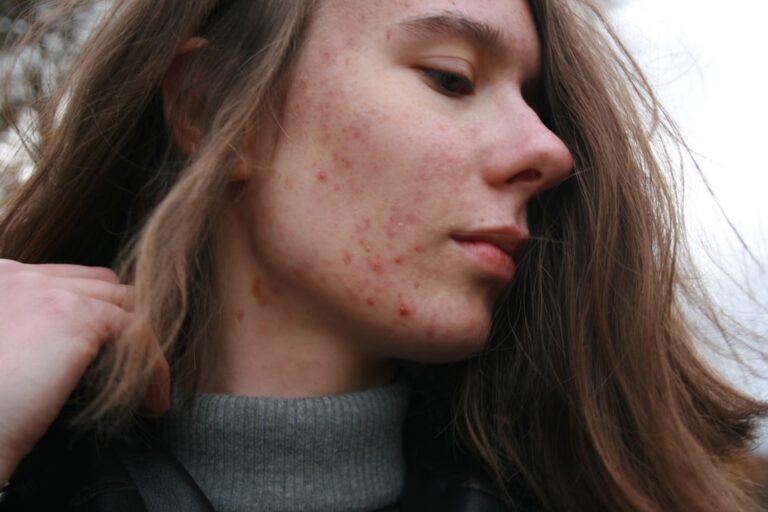 Close-up portrait showing a skin condition relevant to rashes, warts, and acne treatment