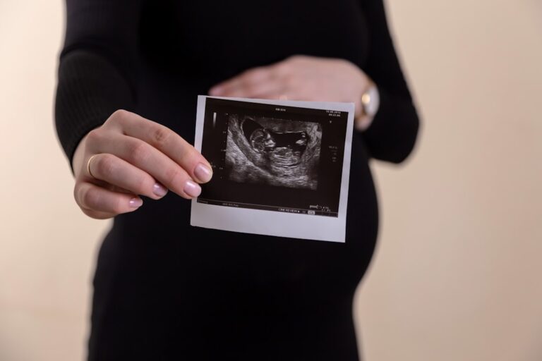 Pregnant woman holding an ultrasound picture, representing ultrasound referrals